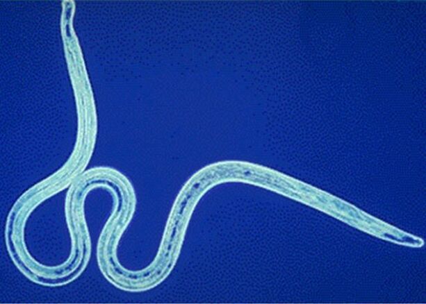 nematodes in the human body