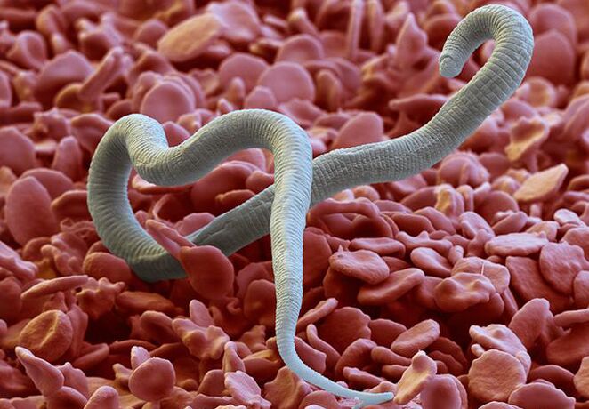 Parasitic worms that eat the human body