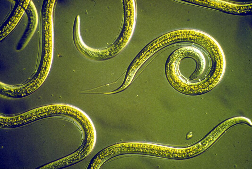 pinworms from the human body