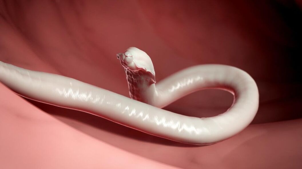 worms from the human body